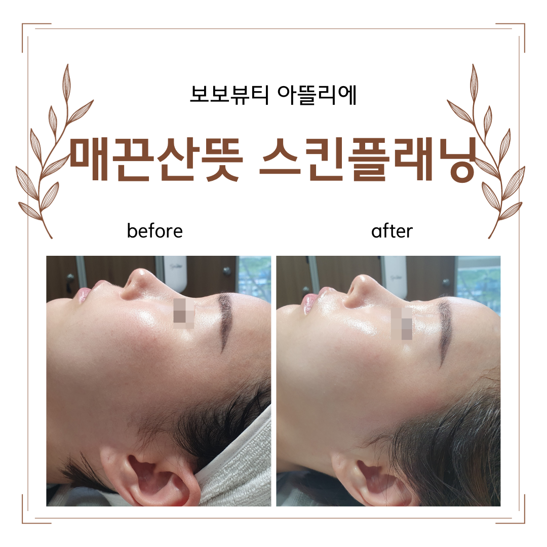 230918 스킨플래닝1.png