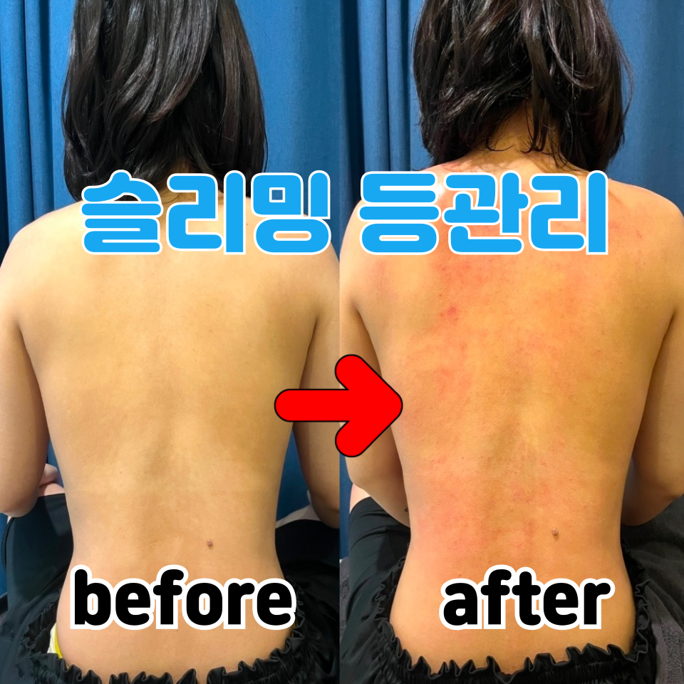 제목을-입력해주세요_-001-80.png