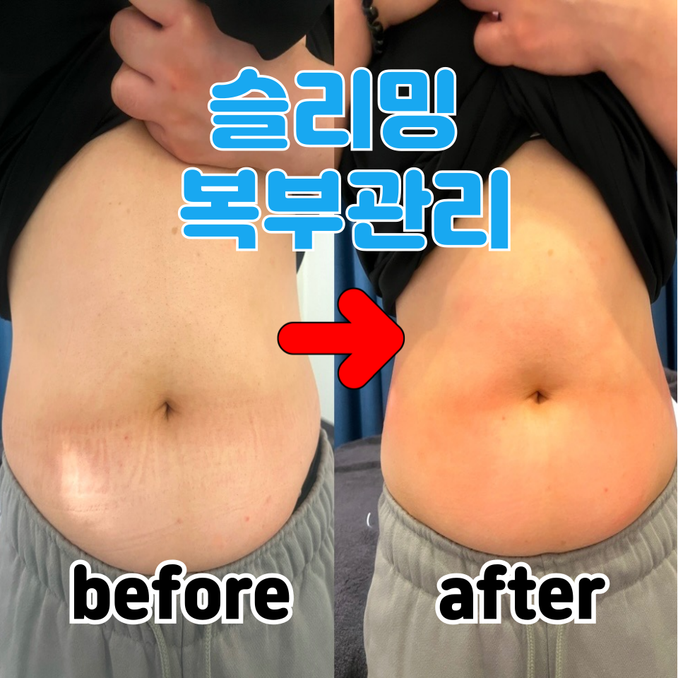 제목을-입력해주세요_-001-82.png