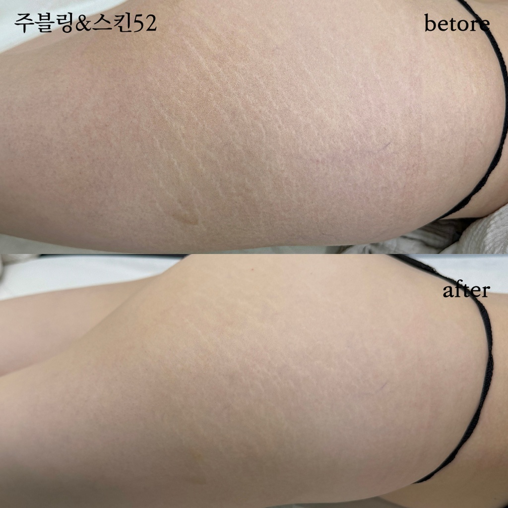 KakaoTalk_20241204_100339464_20.jpg