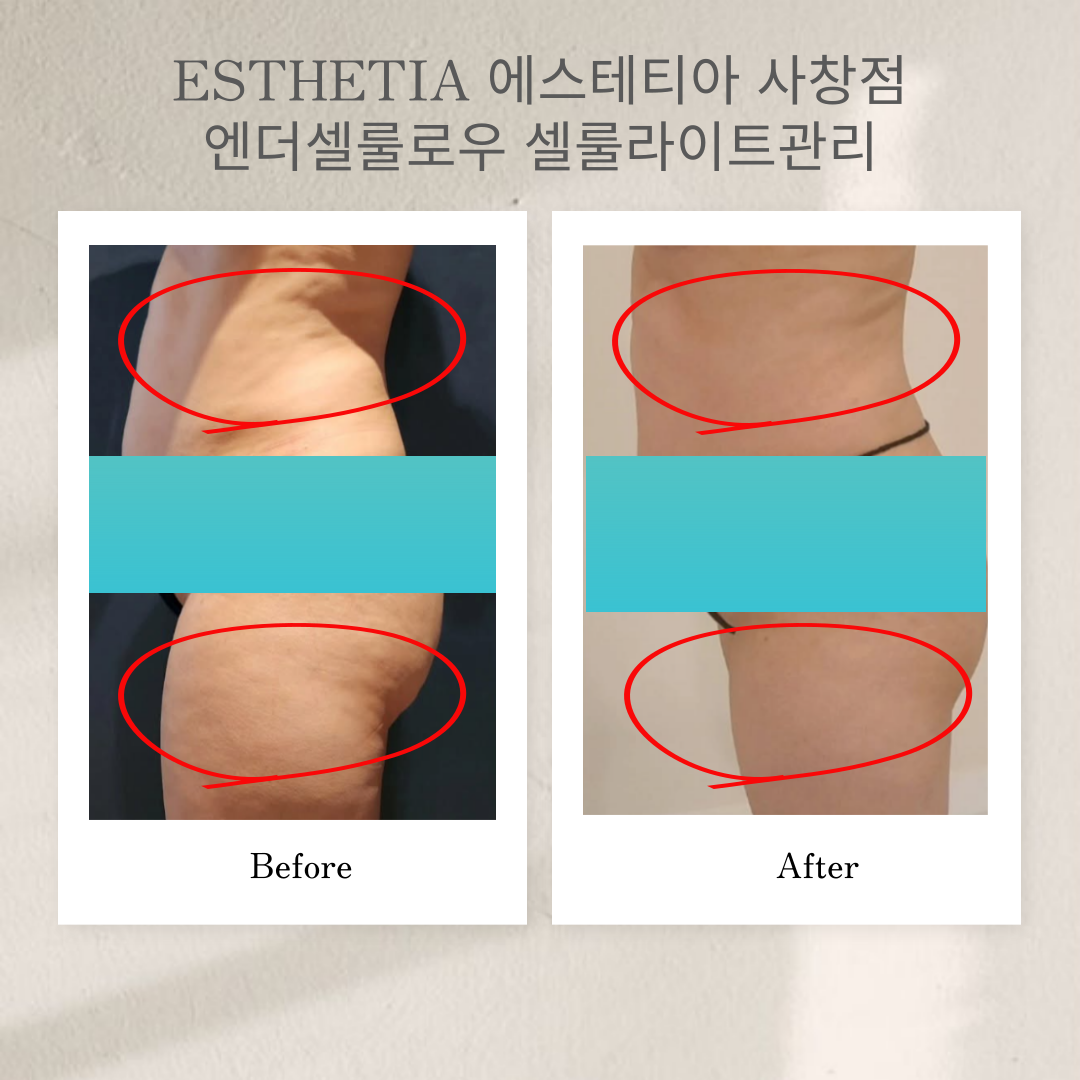 다운로드 (1).png