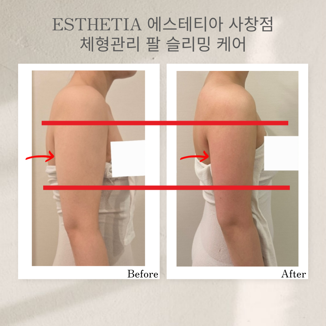 다운로드 (2).png