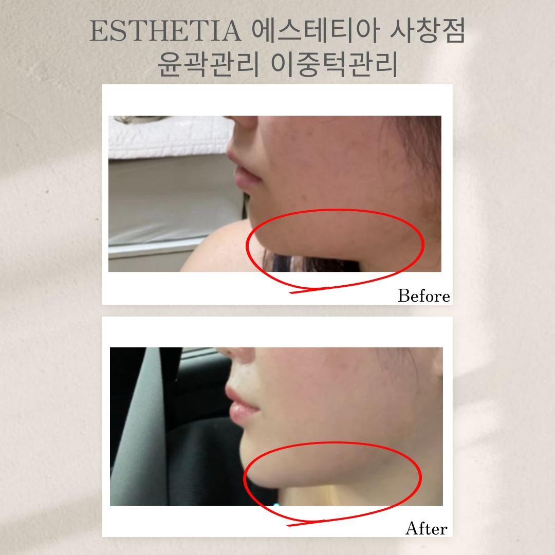 다운로드.png